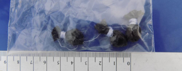 У Білгород-Дністровському поліцейські викрили і затримали  жінку з наркотиками.