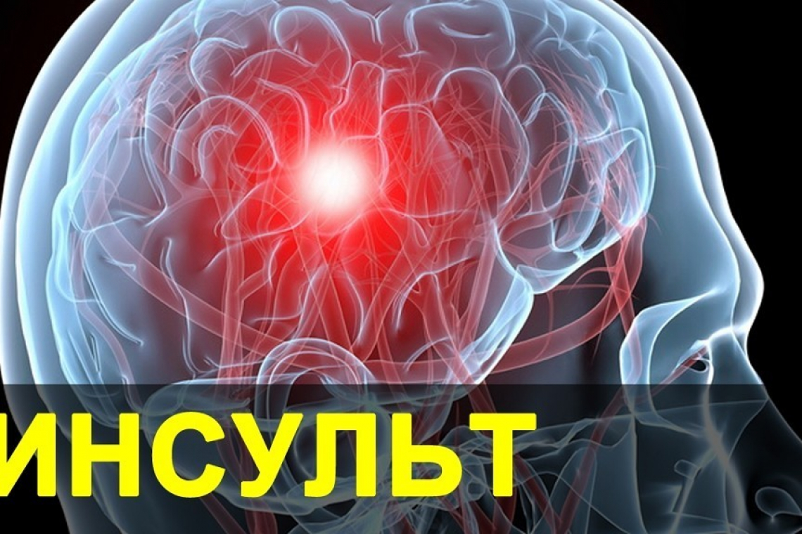 ИНСУЛЬТ
