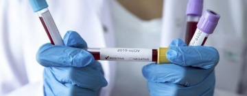 ТЕРМІНОВО: в Україні зареєстровано перший випадок коронавірусу