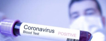 ⚡️Кличко: у Києві сім нових випадків COVID-19