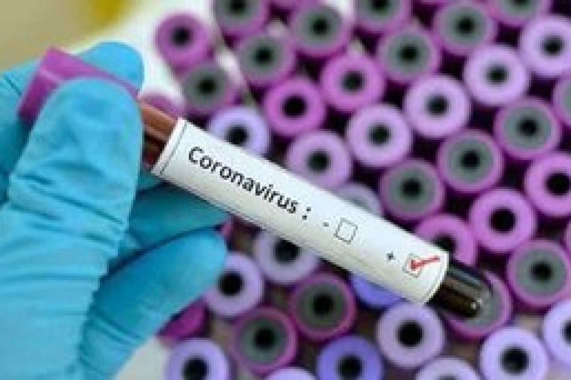 За сутки  80 подозрений на COVID-19 поступили на анализ - МОЗ