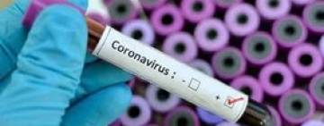 За сутки  80 подозрений на COVID-19 поступили на анализ - МОЗ