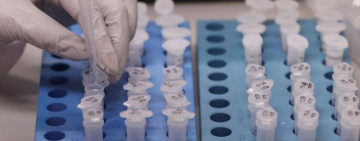 В Одесской области зафиксировано 14 подозрений на COVID-19 