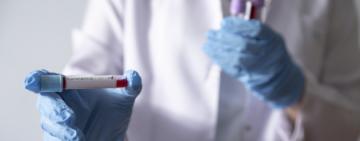 СOVID-19:  в Україні зафіксовано 113 випадків. Що на Одещині?