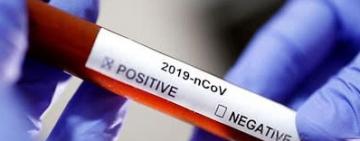 В Измаиле первое подозрение на коронавирус