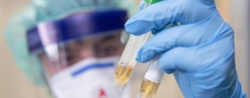 Данные по Одесской области: +1 случай Covid-19 (ИНФОГРАФИКА) - ОГА