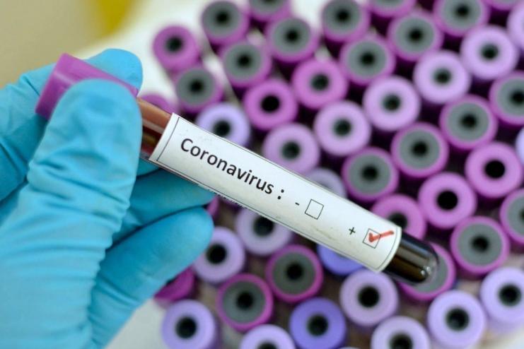 COVID-19: в Україні за добу зафіксовано 311 нових випадків 