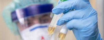 Об эпидситуации в Арцизском районе на 11 апреля