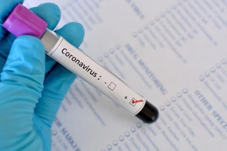 В Україні зафіксовано 3102 випадки COVID-19