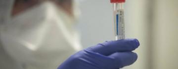 В ещё одном райцентре Одесской области подтвердился  случай COVID-19