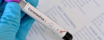 7 областей не подали дані щодо тестування на СOVID-19 минулої доби. 