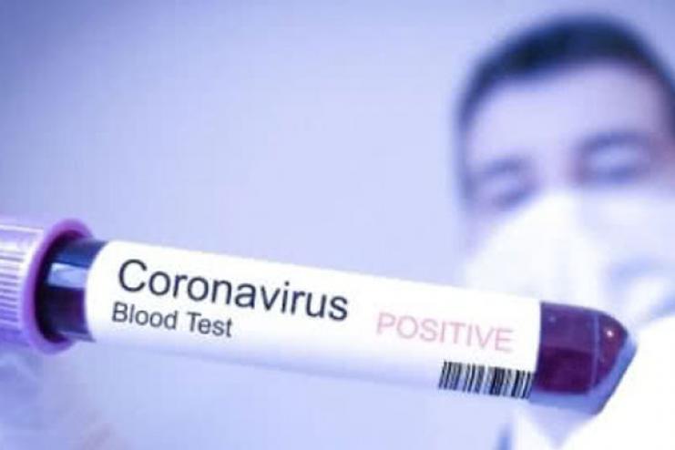  COVID-19: в Україні 477 нових випадків зараження