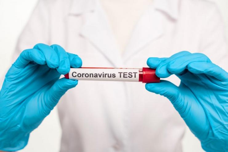 В Україні зафіксовано 8125 випадків COVID-19