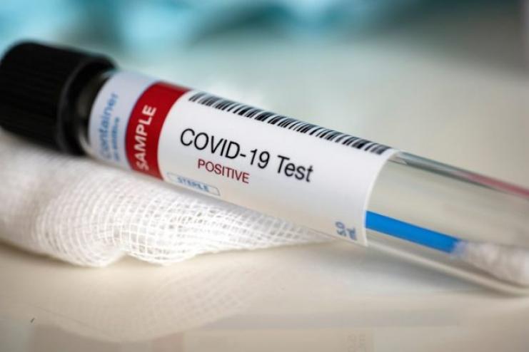 МОЗ: + 507 нових випадків зараження COVID-19 в Україні