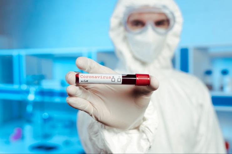 В Україні за добу ще у 325 людей виявили Covid-19