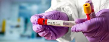 Ранкове "короназведення" від МОЗ