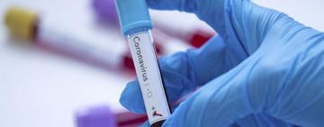 Минздрав сообщил о количестве выздоровевших, заболевших и умерших от COVID-19 в Украине