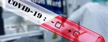  До Ізмаїлу з Covid-19 поступили мешканці з Арцизького, Саратського районів та  Ізмаїльського районів 