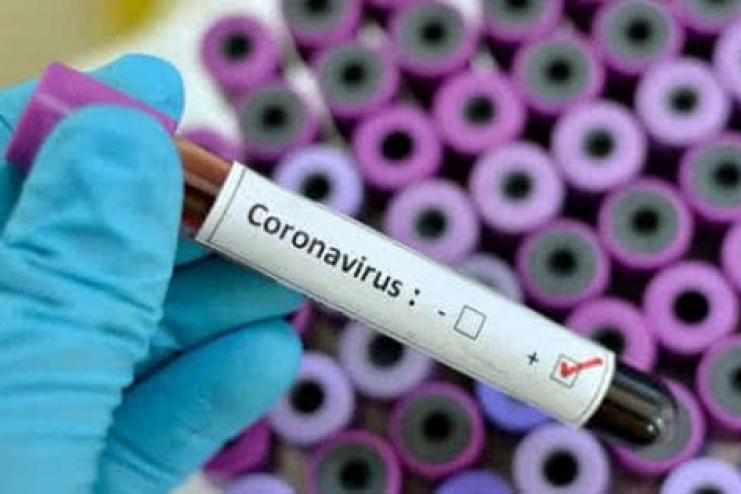 СOVID-19: дані щодо розповсюдження в Україні та на Одещині 
