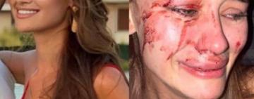  В Турции зверски избили известную украинскую топ-модель