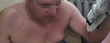 В Одесской области пьяный водитель покусал полицейских