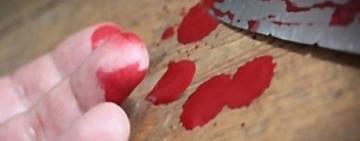 В стенах килийской школы десятиклассник полоснул себя по горлу ножом