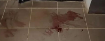 В Рени произошла стрельба, один человек ранен