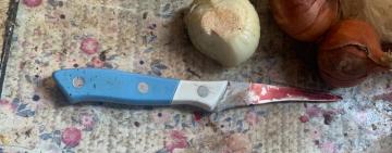 Одесская область: 29-летний житель убил приятеля своего отца