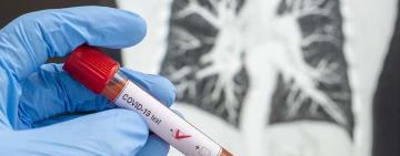 COVID-рекорды: в Украине более 11 тысяч человек заразились коронавирусной инфекцией