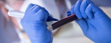 В Одесской области пик заболеваемости Covid-19 ожидается в конце февраля – начале марта, - НСЗУ