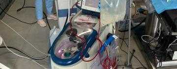 Львівські нейрохірурги провели операцію на мозку 10-річній дівчинці без крововтрати 