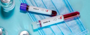 COVID-19: дані ОДА по районам Одещини станом на 10 грудня