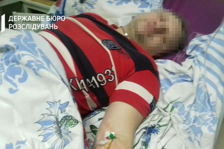 В Одесской области копы избивали и пытали водителя