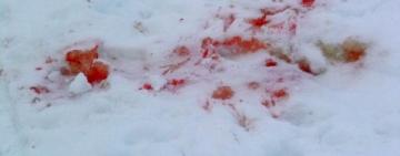 Жительнице Измаила, которая ранила прохожего ножом, объявили подозрение в причинении тяжких телесных повреждений