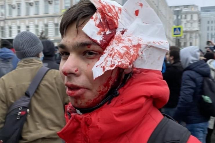 В Росії проходять масові акції протесту на підтримку Навального. Влада традиційно реагує затриманнями