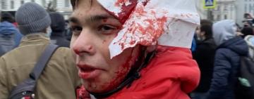 В Росії проходять масові акції протесту на підтримку Навального. Влада традиційно реагує затриманнями