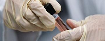 МОЗ потратит 10 миллионов гривен на исследование гомосексуальных отношений между мужчинами