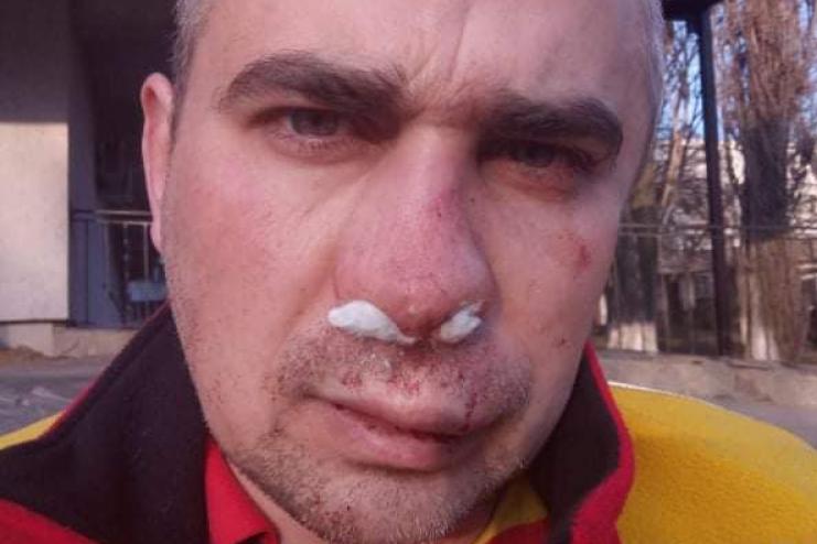 В Одессе сотрудники охранной фирмы жестоко избили ветерана АТО (фото)