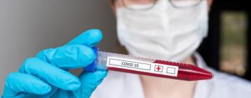 15 850 нових випадків коронавірусної хвороби COVID-19 зафіксовано в Україні за минулу добу