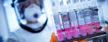 ​​11 476 нових випадків коронавірусної хвороби COVID-19 зафіксовано в Україні станом на 23 березня 2021 року