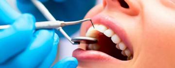 Безкоштовна стоматологія з 1 квітня: перелік послуг