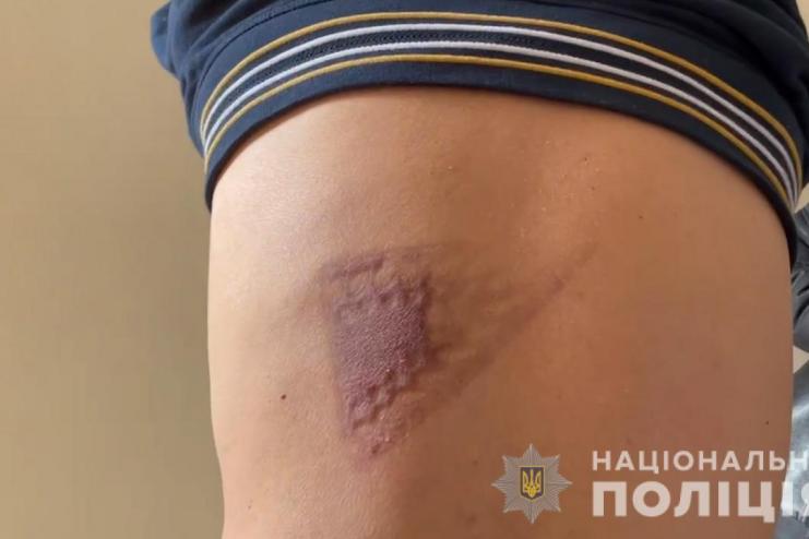 Пытали утюгом и избивали: в Одесской области держали в заложниках двух греков