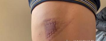 Соучастница – жена: новые подробности похищения и пыток двух греков в Одессе