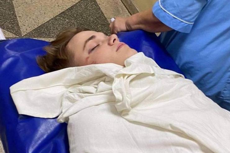 Парень в коме: в Киеве сотрудник госохраны жестоко избил танцора шоу-балета Дорофеевой (видео)