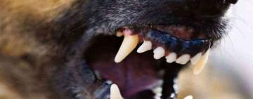 В Одесской области собака укусила ребенка: хозяин заплатит штраф, животное конфискуют