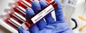 Одещина рекордсмен по захворюваності на коронавірус: 43 летальних випадки за добу