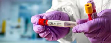 Одесская область на первом месте по заболеваемости COVID-19 