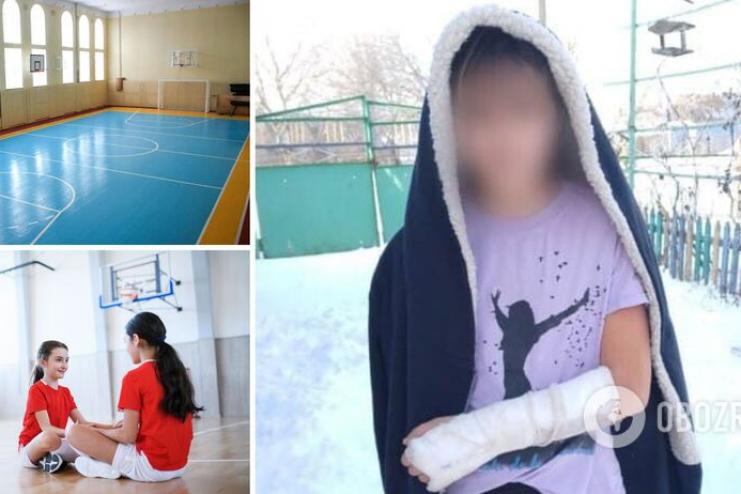 В Одесской области школьница сломала руку, а учительница приложила холодную рыбу и отпустила ее домой