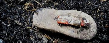 Трагедія на Одещині: маленький хлопчик грався з вогнем і отримав 90 відсотків опіків тіла
