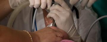 Одеські лікарі врятували річну дитину, яка проковтнула стороннє тіло